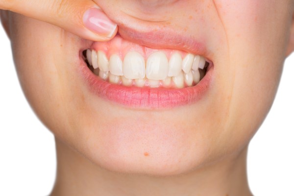 Non Surgical Vs  Surgical Gum Disease Treatment: What To Expect